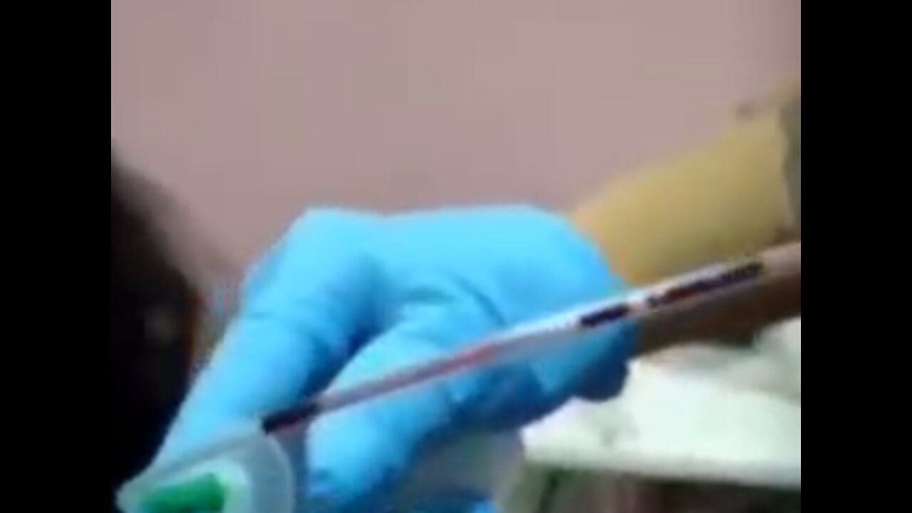 Vaccinated Blood like GEL & is USELESS for Red Cross