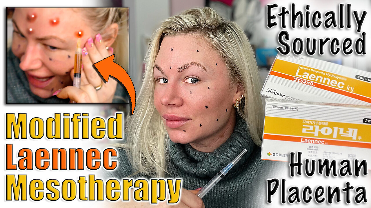 Modified Laennec Mesotherapy for a Glowing Face! AceCosm | Code Jessica10 saves you Money