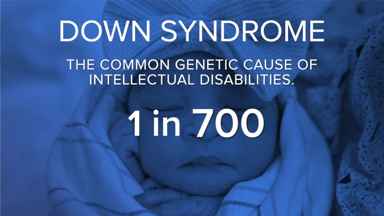 Buffalo Strong: What is Down Syndrome?