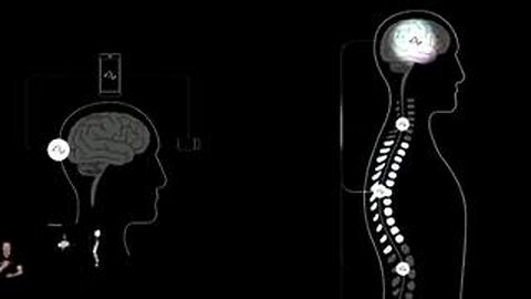 Elon Musk's Neuralink Gets FDA Approval to Start Human Trials