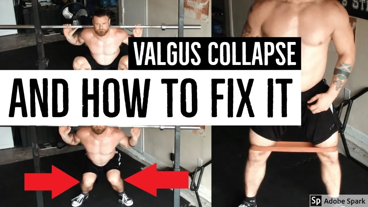 "My Knees Collapse When I Squat" - Why You Have Valgus Knee And How To Fix It