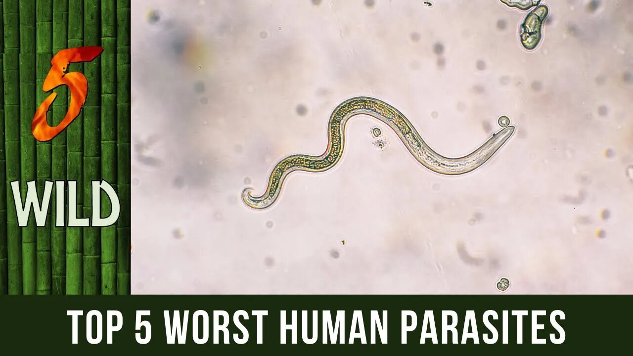 Top 5 Worst Human Parasites Found Inside The Body | 5 WILD