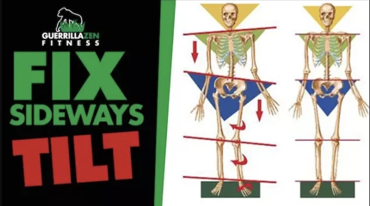 Uneven Hips aka Lateral Pelvic Tilt | Fix the ROOT cause!