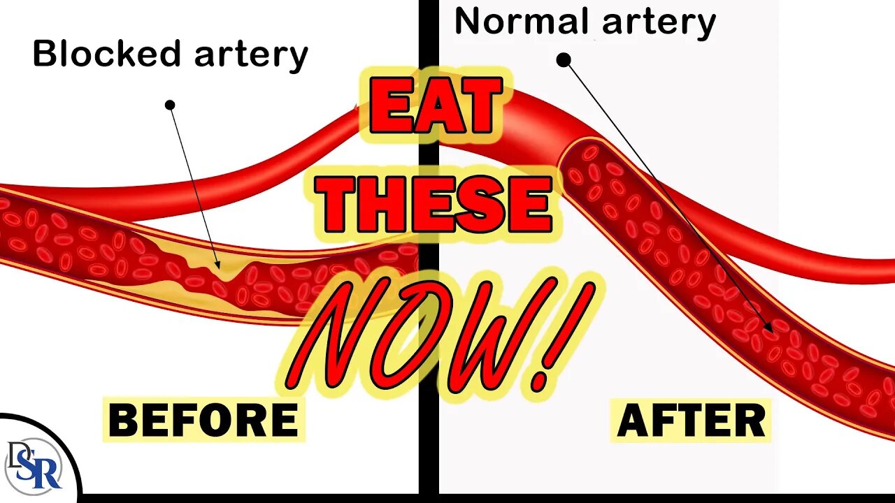 𝟭𝟬 𝗕𝗲𝘀𝘁 𝗙𝗼𝗼𝗱𝘀 For Cleaner Arteries & Circulation