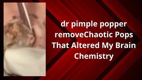 dr pimple popper remove Chaotic Pops That Altered My Brain Chemistry