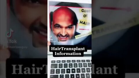 Hair Transplant TikToks I Found Today April 29th, 2022