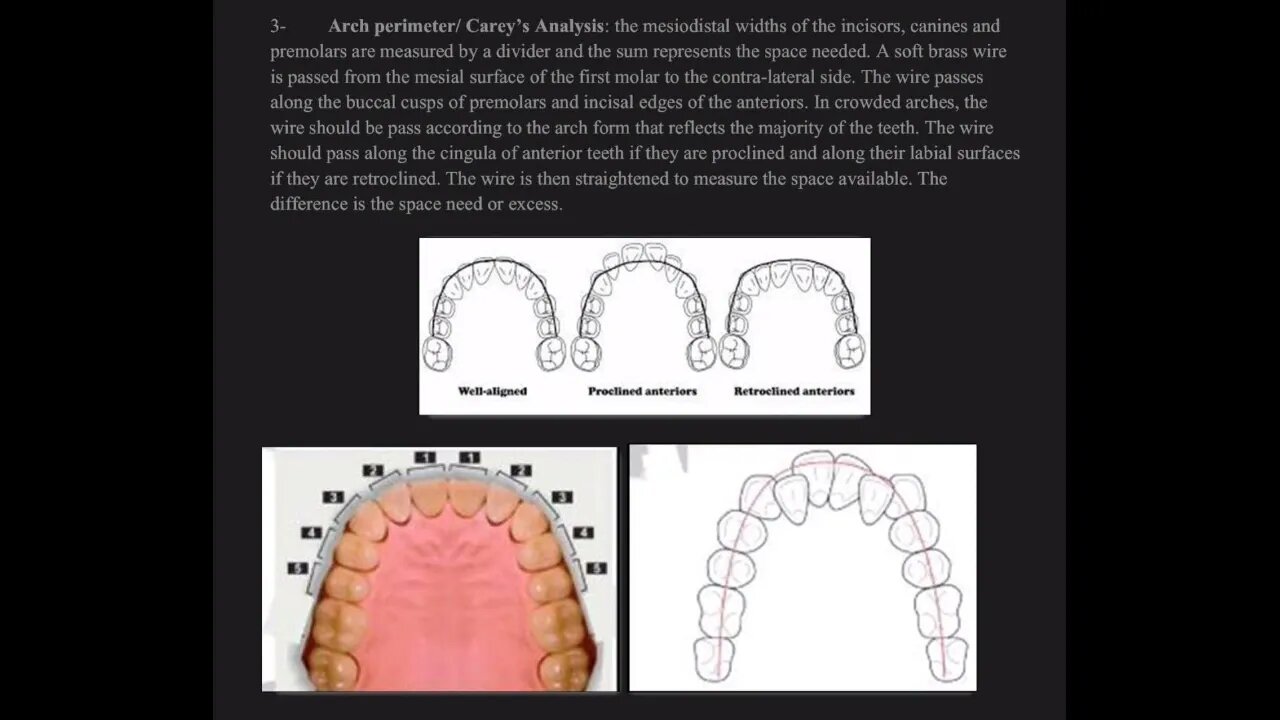 Orthodontics L9 (Space Analysis)