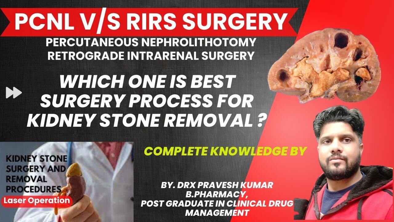 PCNL vs RIRS Surgery | Kidney Stone removal | Kidney Stone | Drx Pravesh Vlogs