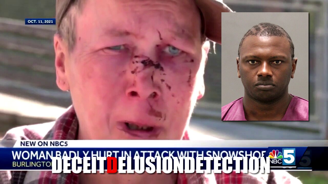 A black murder suspect randomly attacks white woman with a snowshoe, breaking her nose