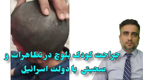 جراحت کودک بلوچ در تظاهرات و صحبتی با دولت اسرائیل