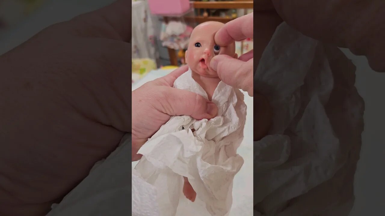 Eye Surgery for Baby #shorts