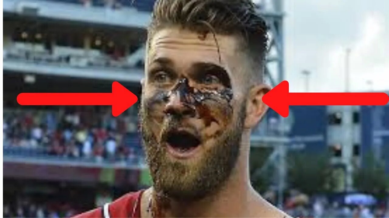 MLB "Black Eye" Moments