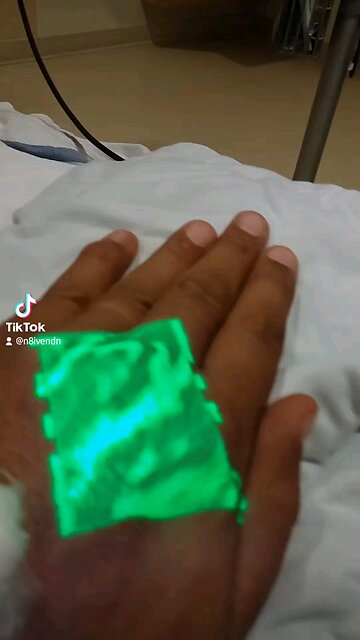 Playing with the vein finder on myself.