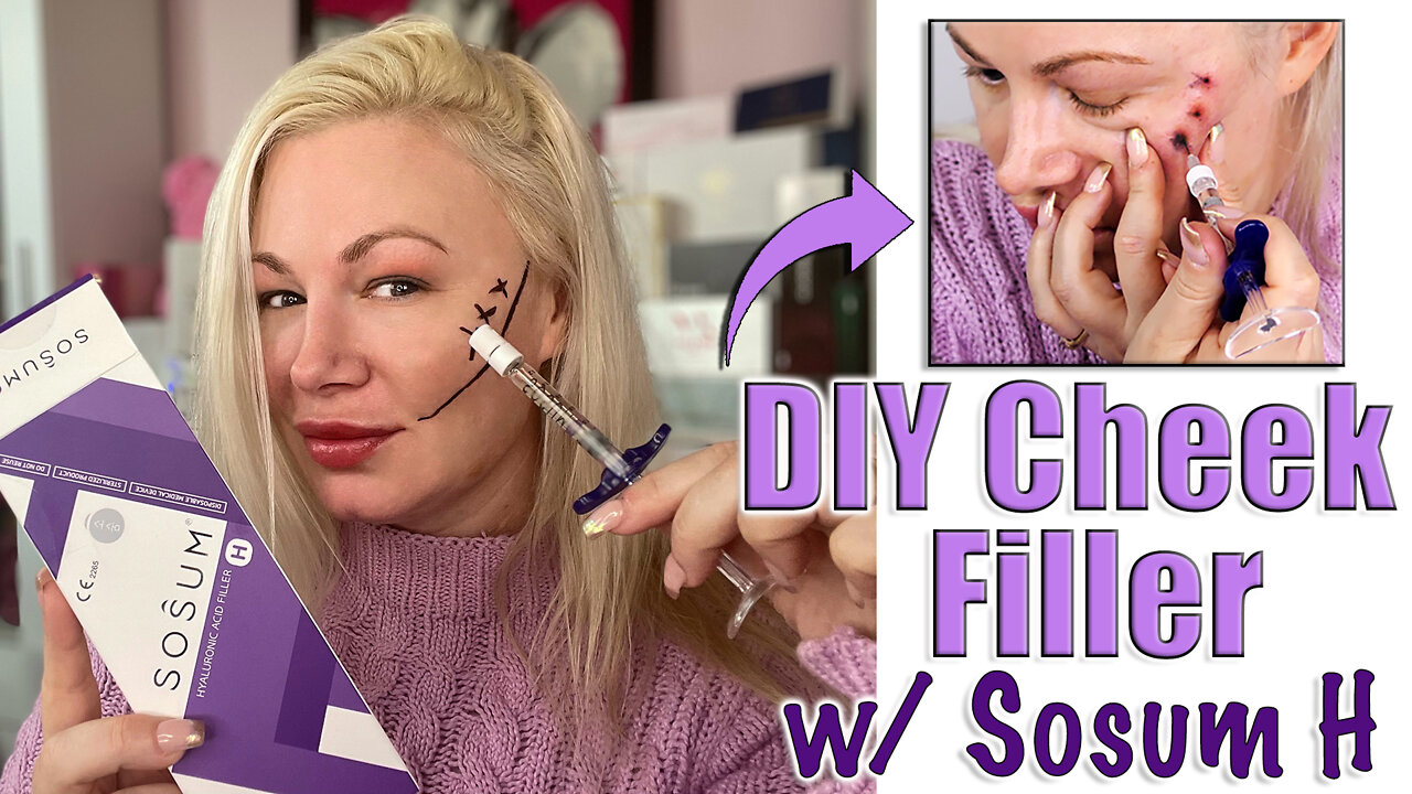 DIY Cheek Filler with Sosum H from Glamderma.com | Code Jessica10 Saves you Money!