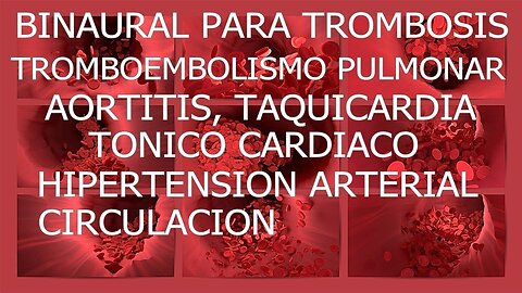 BINAURAL PARA TROMBOSIS VENOSA, TROMBOEMBOLISMO PULMONAR, AORTITIS, TAQUICARDIA, TÓNICO CARDÍACO