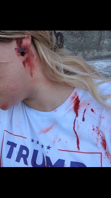 Trump Supporter Beaten by Deadbeats