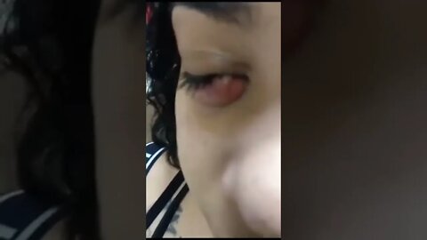 Bolha Estranha nos Olhos - Já viu Algo Assim? Sabe o que é?