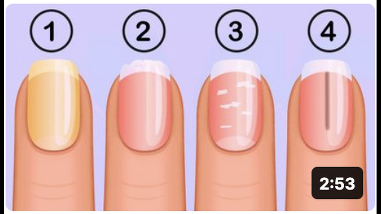 5 Things Your Nails Can Tell You About Your Health