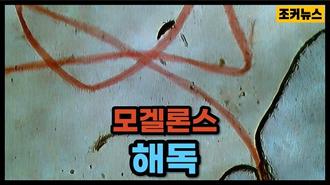 모두가 봐야할 영상 Morgellons Detox