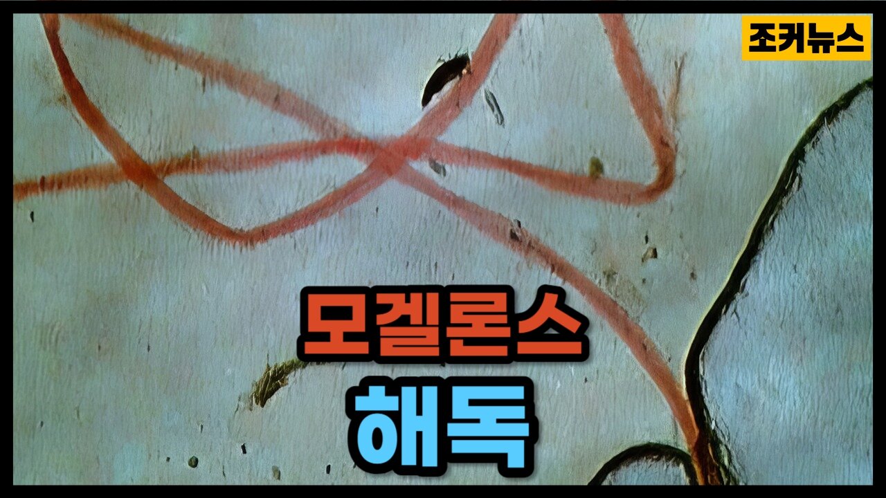 모두가 봐야할 영상 Morgellons Detox