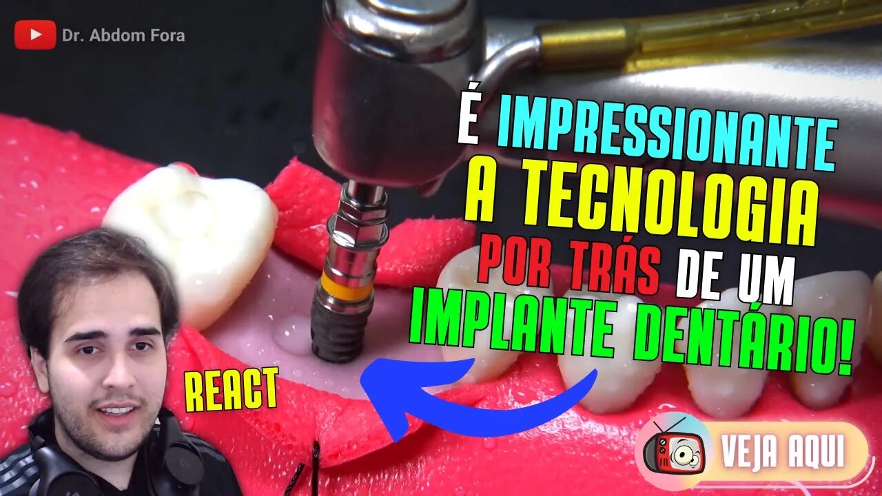 VOCÊ SABE como são feitos os IMPLANTES DENTÁRIOS??? | Veja Aqui