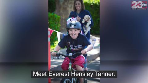 Everest Hensley Tanner is one of 200 people worldwide who have Wiedemann-Steiner Syndrome