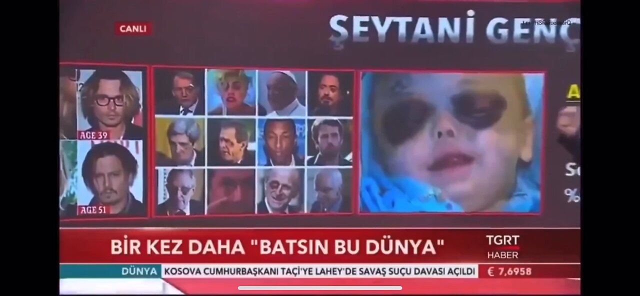 The Wests “Adrenochrome Trade” ￼made “Mainstream News” in Turkey and other European countries