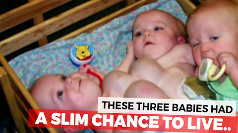Conjoined Triplets Given Slim Chance To Live