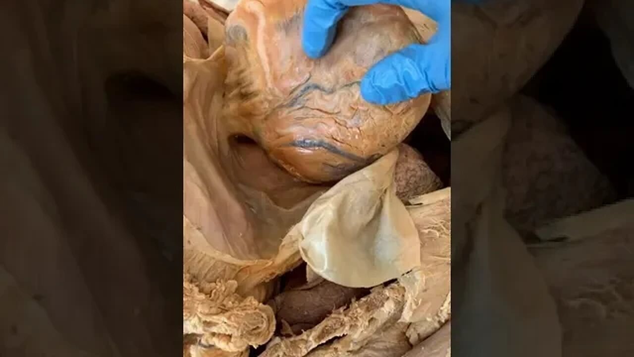 Not All Muscle Tissue Is the Same...