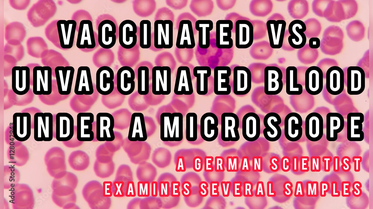 Blood Cells of those Vaccinated are Breaking Down