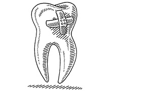 What it means when you dream about your teeth falling out