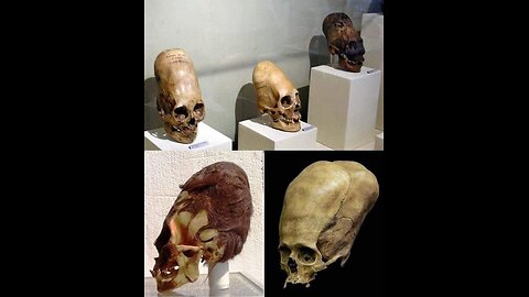 An Elongated History