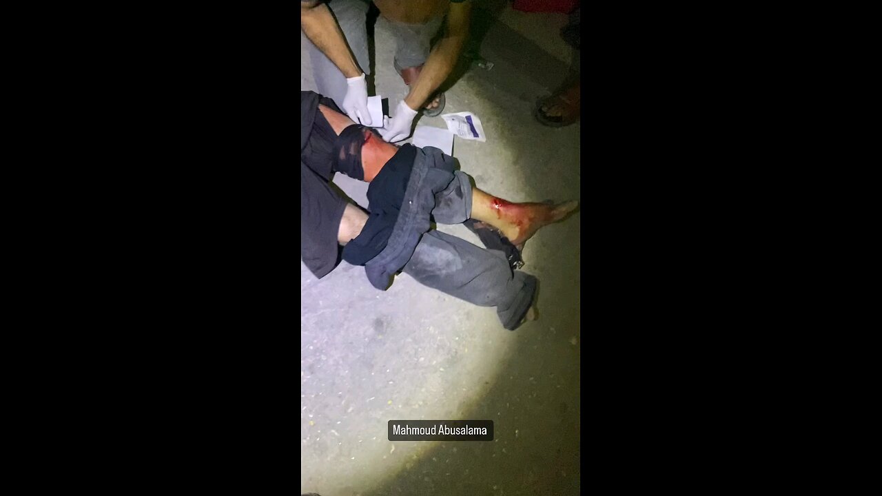 معالجة الإصابات نتيجة القصف المدفعي على مخيم جباليا شمال غزة لعدم قدرة سيارات الإسعاف الوصول للمكان