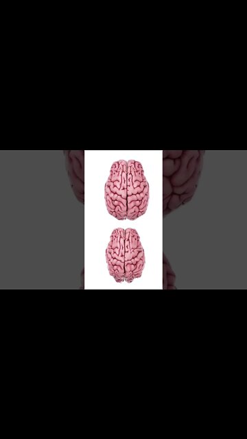 What Stress Does to the Brain 🧠 #shorts