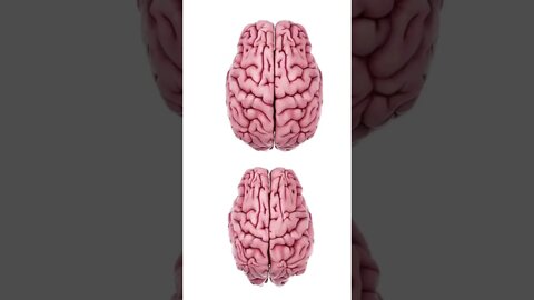 What Stress Does to the Brain 🧠 #shorts