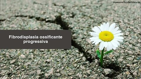 Fibrodisplasia ossificante progressiva (FOP)