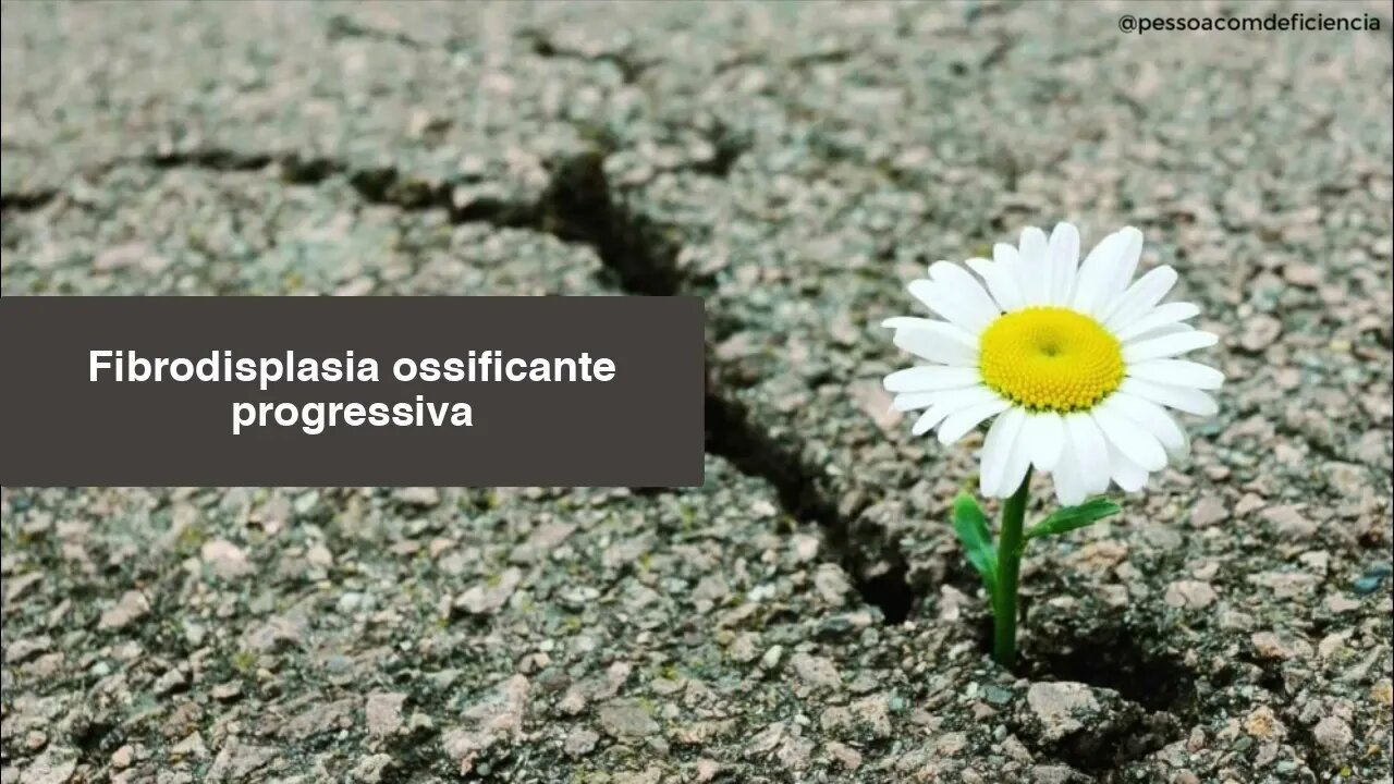 Fibrodisplasia ossificante progressiva (FOP)
