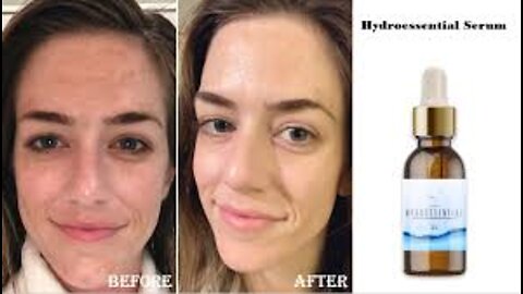 How To Skin Care Serum With Hydrossential ?