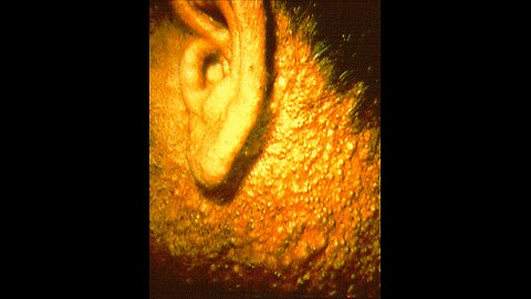 The Treatment: The Story of Those Who Died in the Cincinnati Radiation Tests (2002)