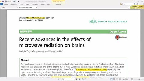 MICROWAVE RADIATION ON BRAINS - THE LETHAL 5G EXPOSED