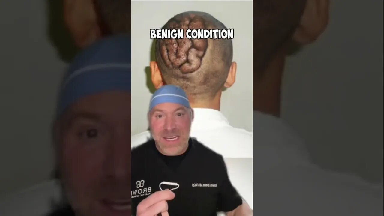 Crazy Head Brain Wrinkles 🧠#shorts