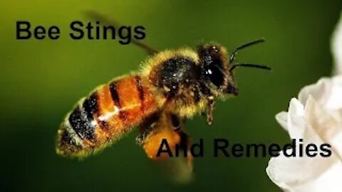 Bee Stings and Remedies