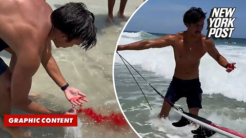 Surfer calmly walks away from 'gnarly' shark bite