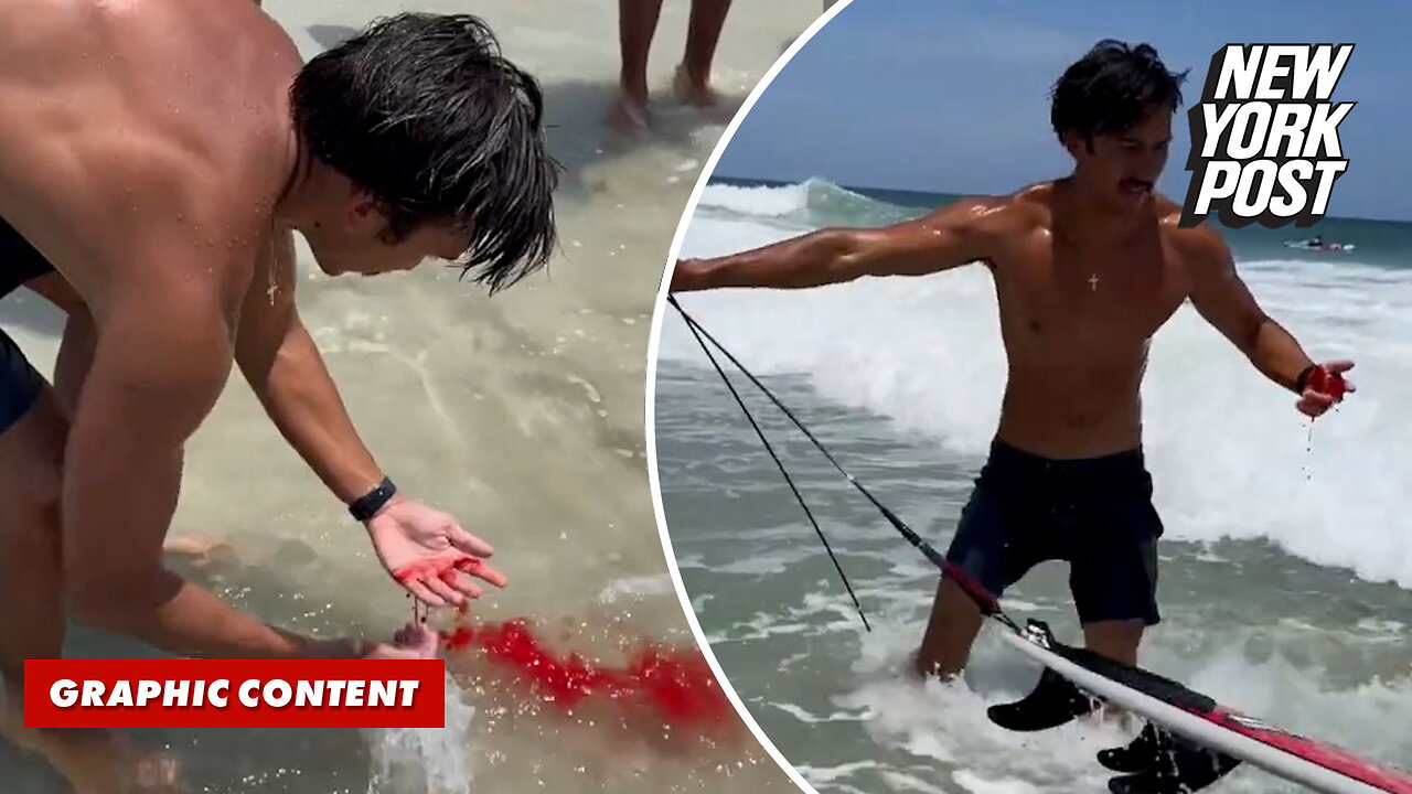 Surfer calmly walks away from 'gnarly' shark bite