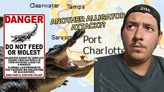 Man Loses arm to Alligator in Florida