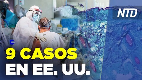 CDC identifican 9 casos de viruela del mono; Funcionario: Tirador de Texas "entró sin obstáculos”