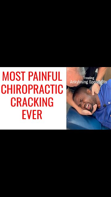 Ankylosing Spondylitis hard Chiropractor Cracking