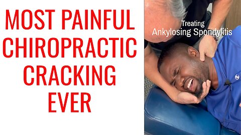 Ankylosing Spondylitis hard Chiropractor Cracking