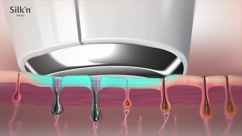 Silk'n New Age Beauty Devices