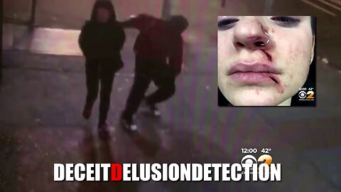 White female slashed in the face by black suspect